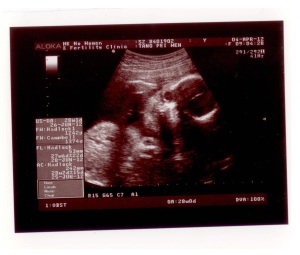 Baby Scan 9-04 April 2012